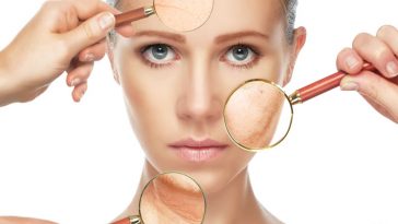 Kırışıklıklarımı Nasıl Azaltırım?